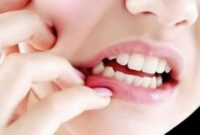 pertanyaan tentang mengatasi gusi bengkak