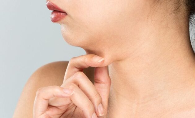 Double Chin kesimpulan