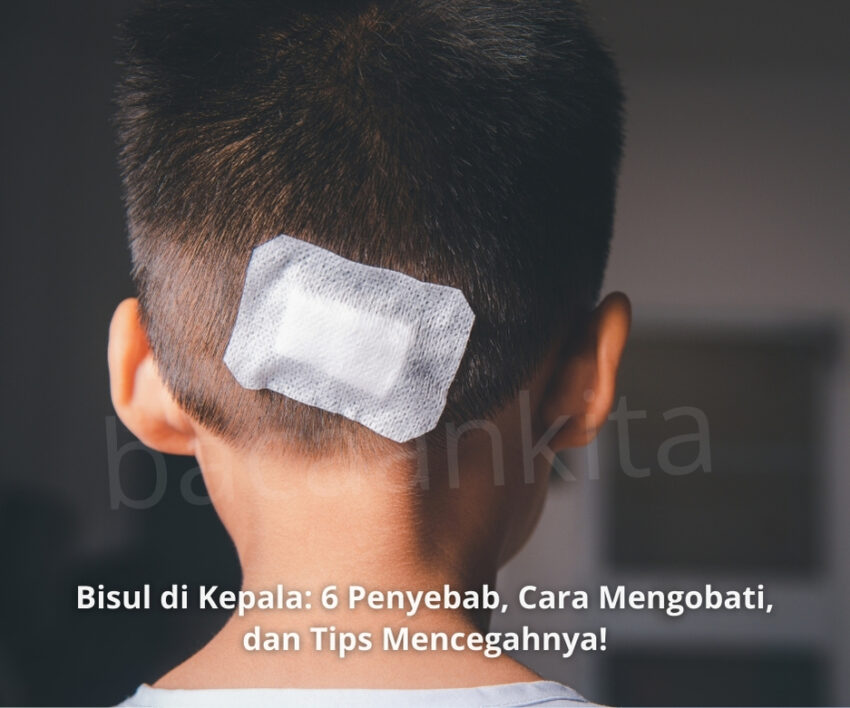 bisul di kepala