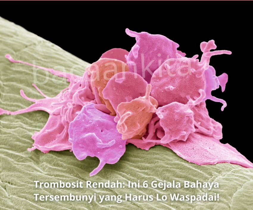 trombosit rendah