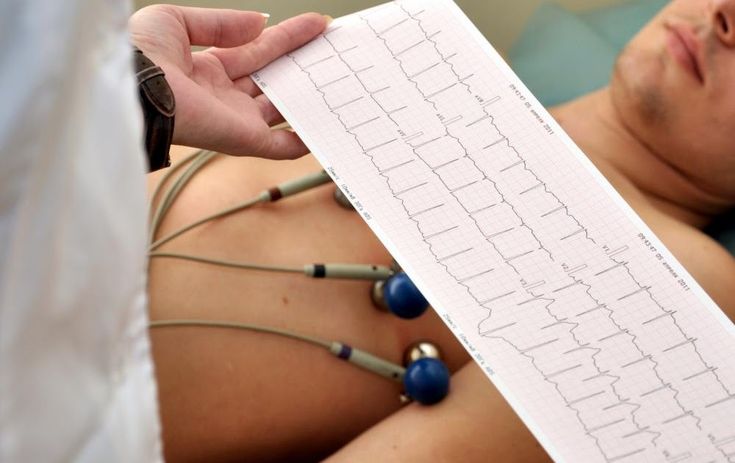 apa itu elektrokardiogram 1