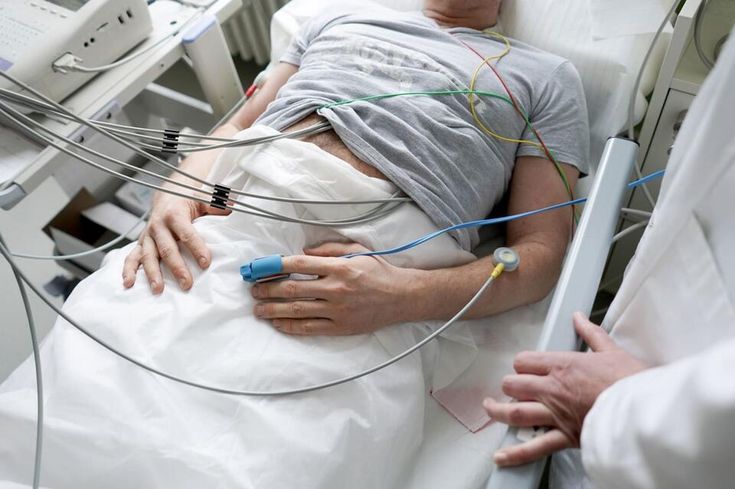 pertanyaaan elektrokardiogram 2