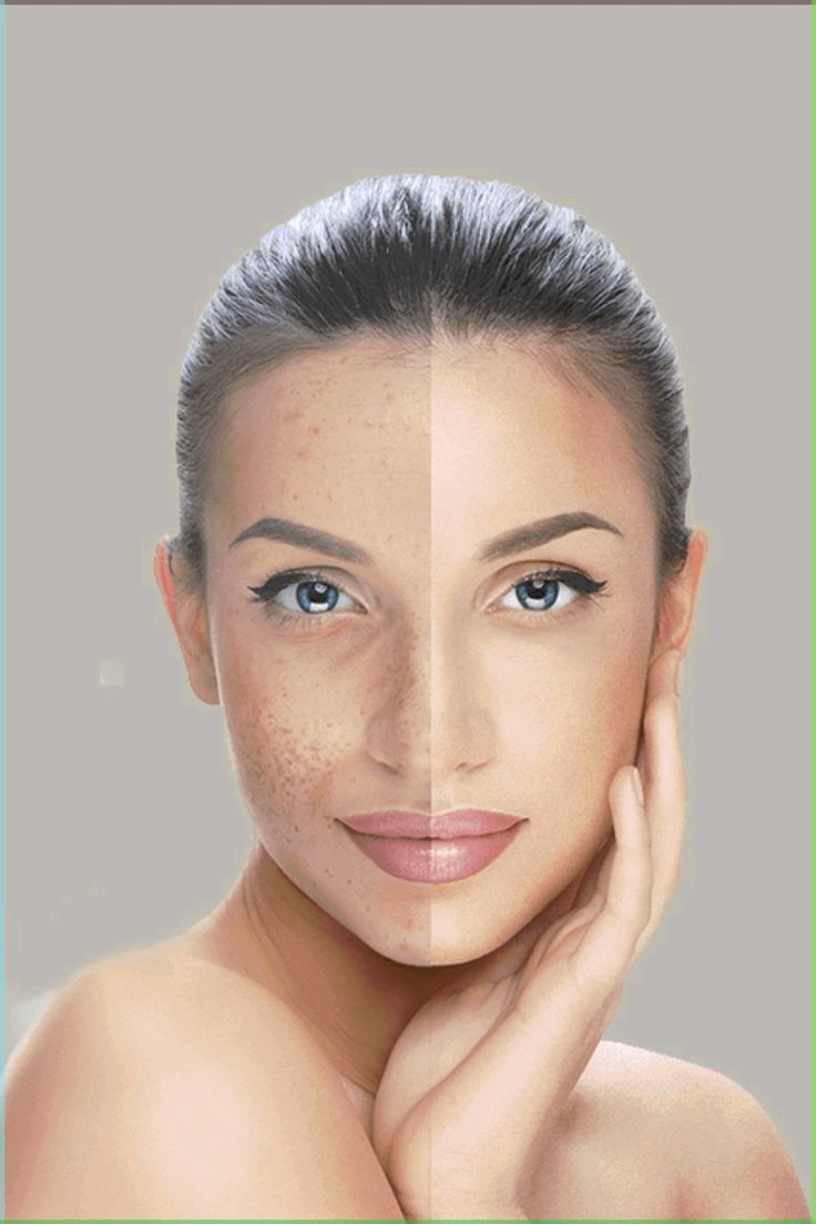 pertanyaan seputar Hybrid Sunscreen 6